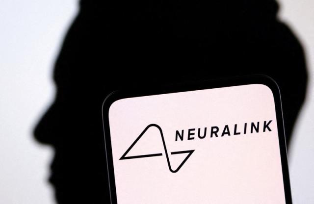 FIRST NEURALINK PATIENT ALARMED AS DEVICE STARTS LOSING FUNCTIONALITY