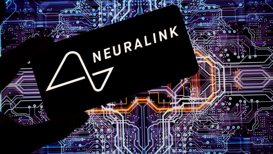 Neuralink